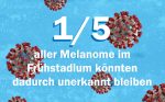 Ein Fünftel unerkannte Melanome