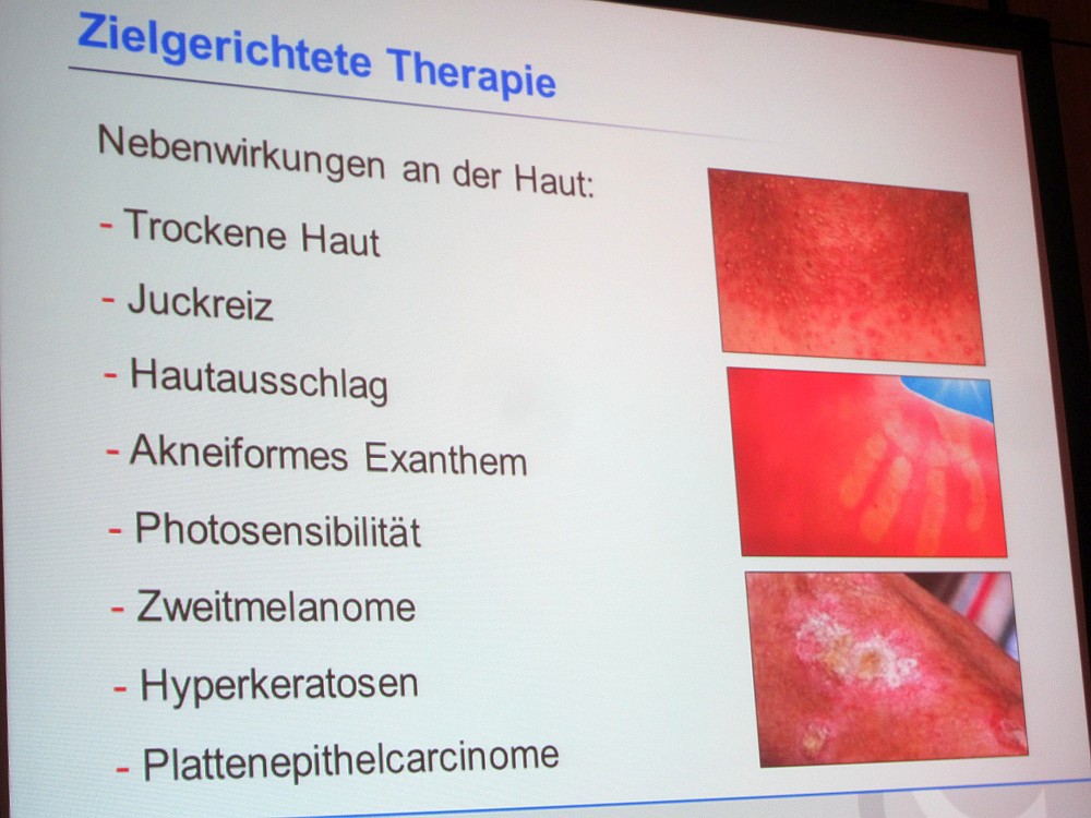 Hautreaktionen Übersicht